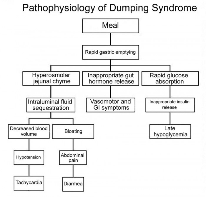 Late Dumping Syndrome.jpg